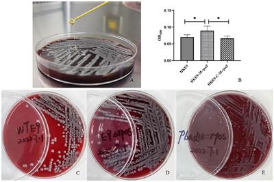 Transcriptomic and phenotype analysis revealed the role of rpoS in stress resistance and virulence of a novel ST3355 ESBL-producing hypervirulent Klebsiella pneumoniae isolate